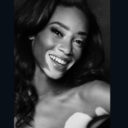 Model Winnie Harlow is changing the face of fashion Style