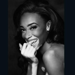 Winnie Harlow’s changing the face of fashion