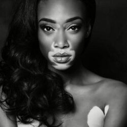 46 best Winnie Harlow image