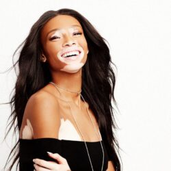 Why Model Winnie Harlow Hates Trying on Clothes