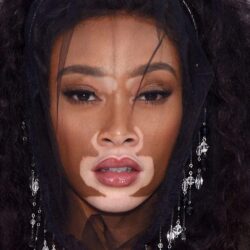 Winnie Harlow: ‘It’s Beautiful That the Age of Cookie
