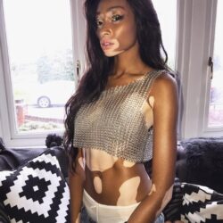 Winnie Harlow Wallpapers InstaFitGirls – INSTAGRAM FITNESS GIRLS